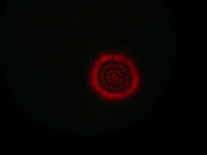 intrafocal.JPG