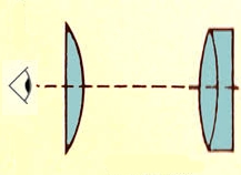 OcularHUTACT.jpg