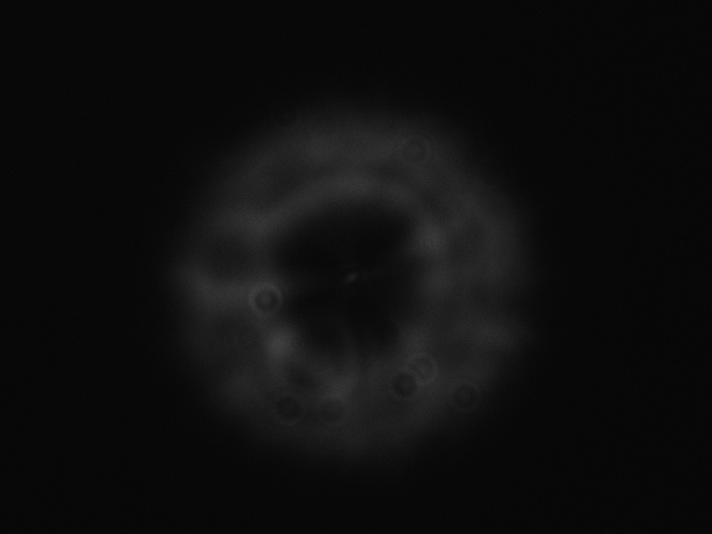 Intrafocal 3X.JPG