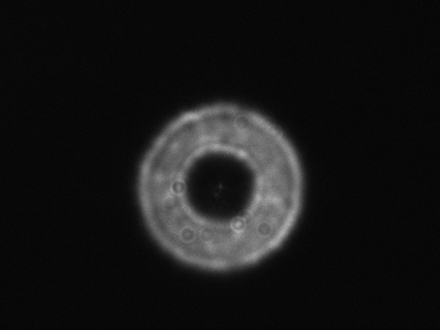 Intrafocal.JPG