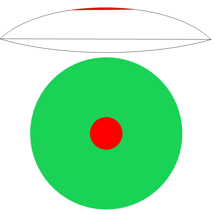 Lentila defecta binoclu.png
